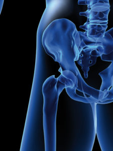osteoporose-sante-publique