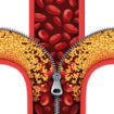 cholesterol-policosanol-efficacite