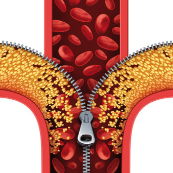 cholesterol-policosanol-efficacite