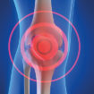 La chondroïtine : une source de bienfaits pour vos articulations !