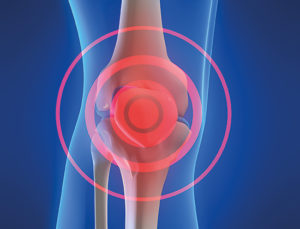 La chondroïtine : une source de bienfaits pour vos articulations !