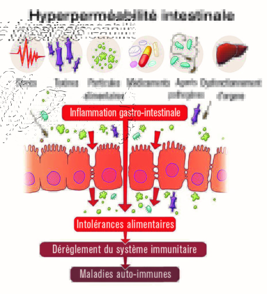 hyperpermeabilite-intestinale