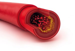 LE CHOLESTEROL, mythe ou réalité ?