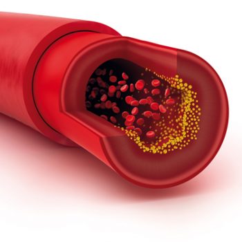 LE CHOLESTEROL, mythe ou réalité ?