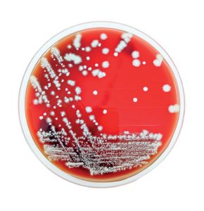 petri
